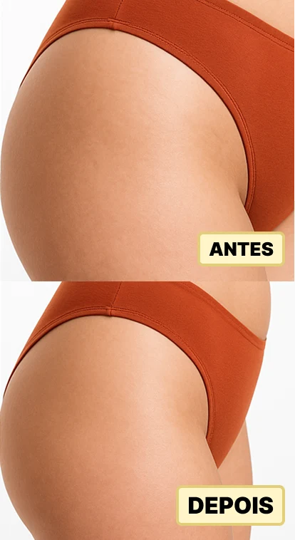 ANTES. EDPOIS Mock-1