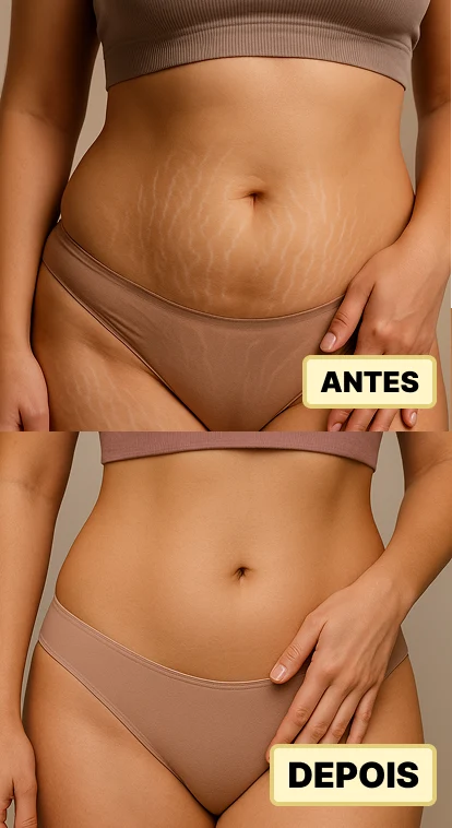 ANTES. EDPOIS Mock