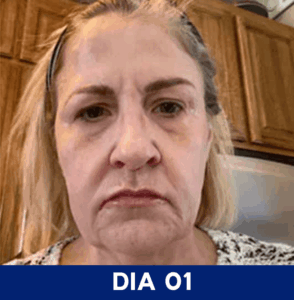 Dia-01-1.png