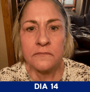Dia-14-1.png